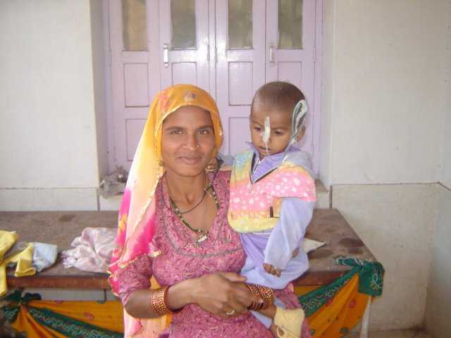 malnutrition photo