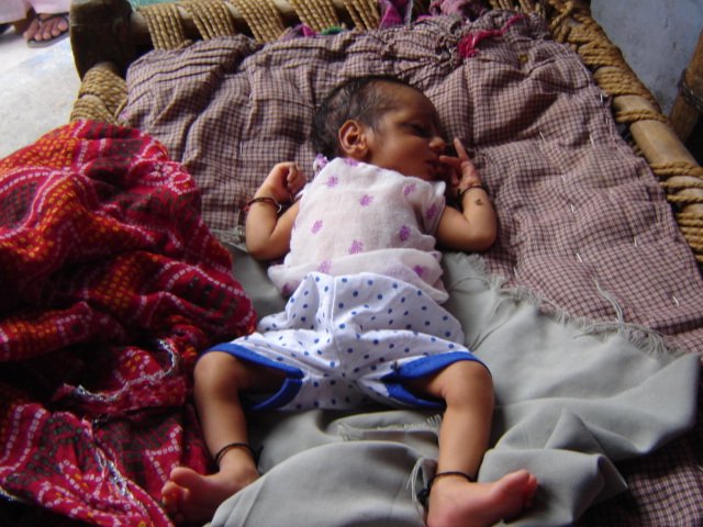 malnutrition photo